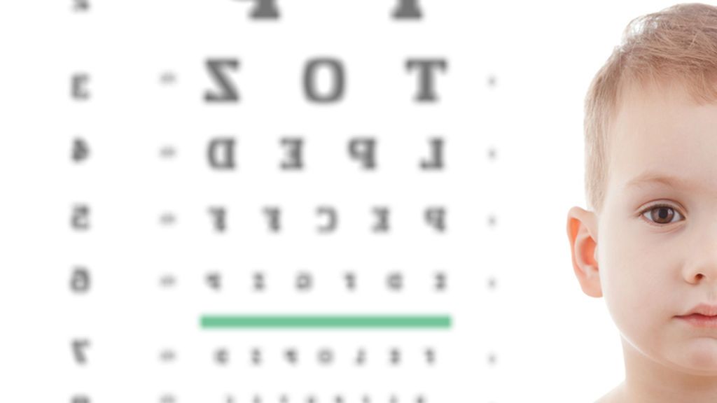 ¿Cómo puedo identificar si mi hijo tiene un ojo vago?