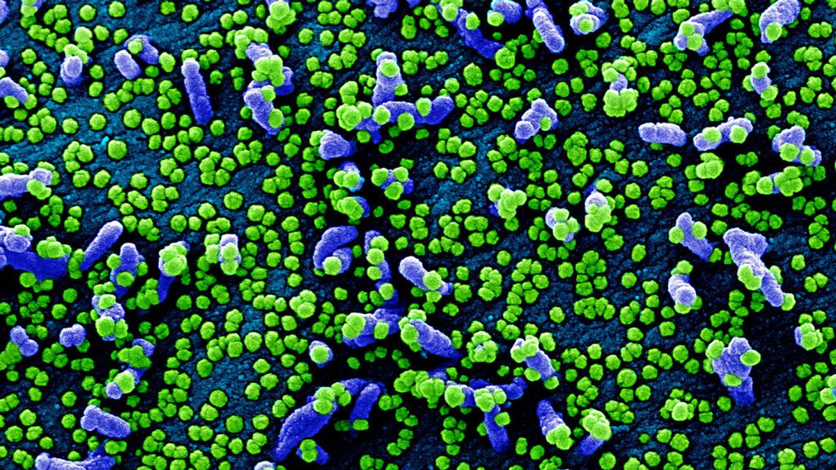 El CSIC quiere fabricar anticuerpos contra el coronavirus en el laboratorio El CSIC quiere fabricar anticuerpos contra el coronavirus en el laboratorio