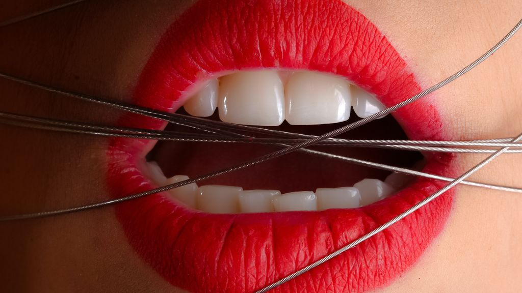 Ortodoncia con más de 50, la estética no está reñida con la edad.