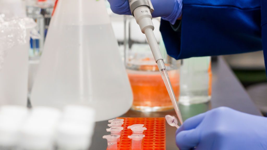Investigadores españoles demuestran que el Covid-19 provoca lesiones en la medula ósea Investigadores españoles demuestran que el Covid-19 provoca lesiones en la medula ósea