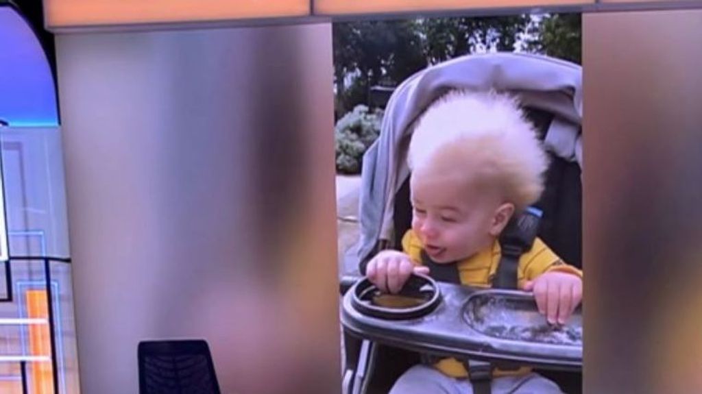 El viral de Futura: el bebé con el síndrome del cabello impeinable que solo sufren 100 personas