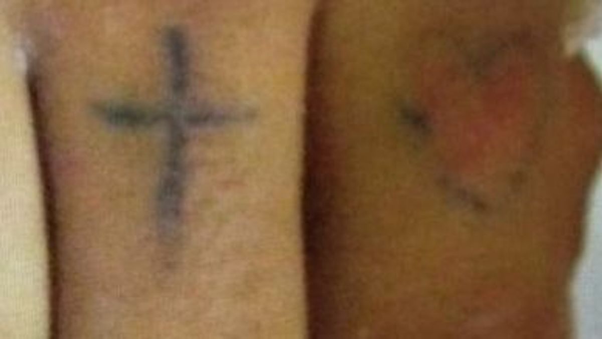 Tatuajes paciente ingresado en UCI