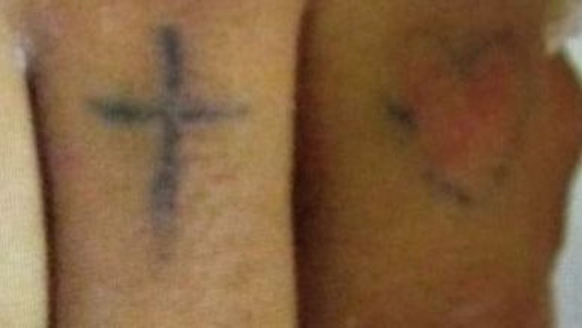 Tatuajes paciente ingresado en UCI Tatuajes paciente ingresado en UCI