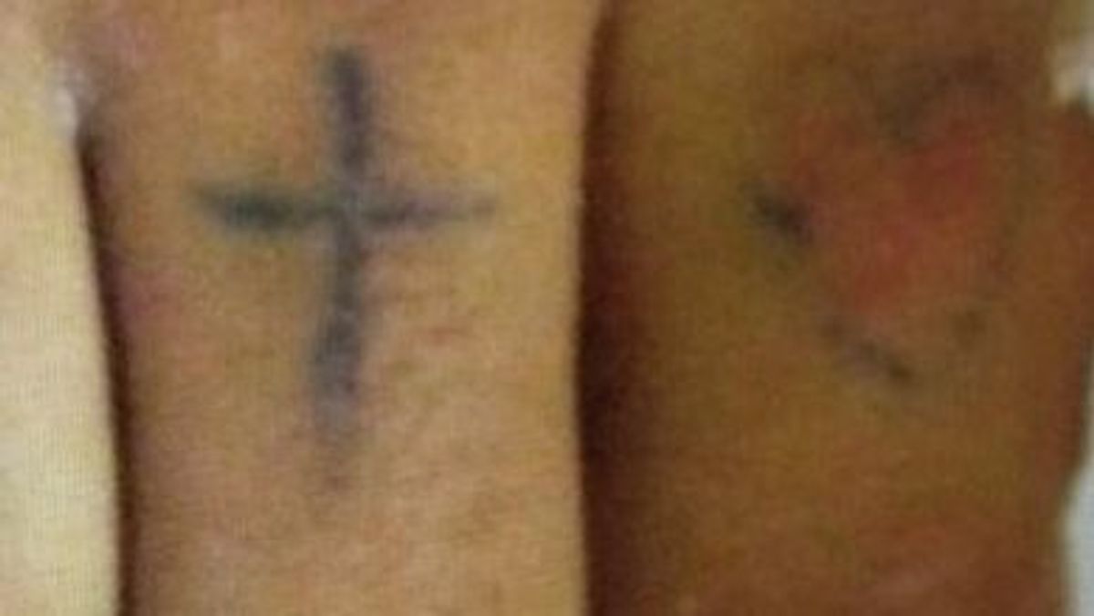 Tatuajes paciente sin identificar Virgen del Rocío Tatuajes paciente sin identificar Virgen del Rocío