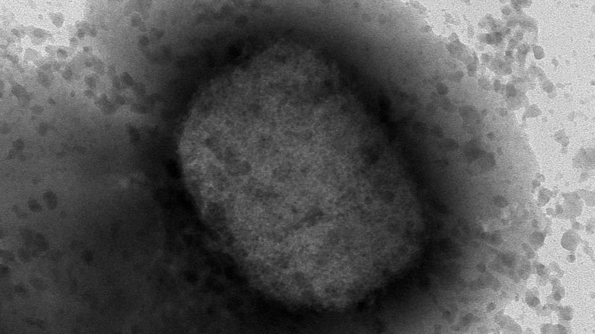 Virus de la viruela del mono por microscopía electrónica