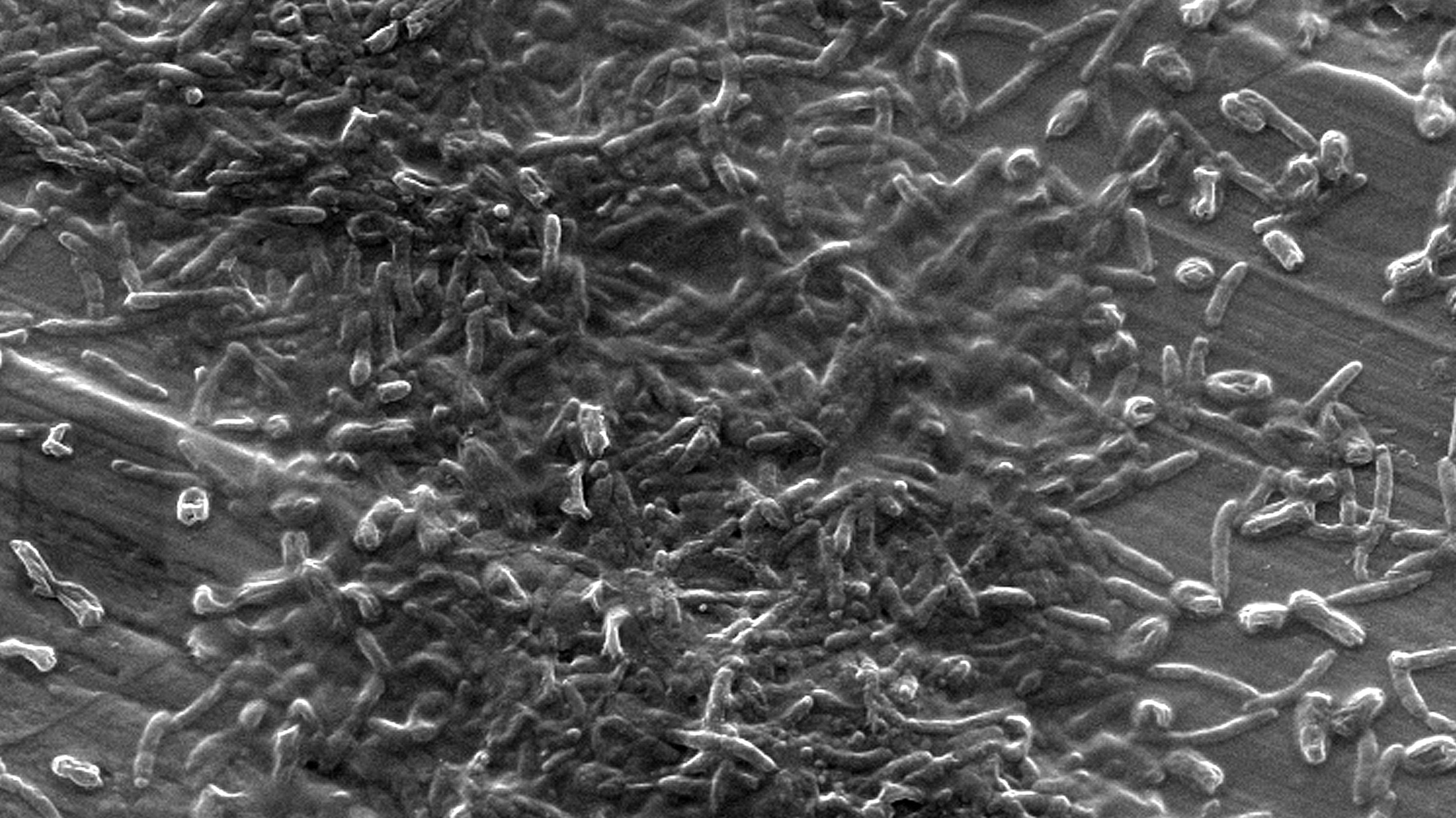 Bacteria Legionella