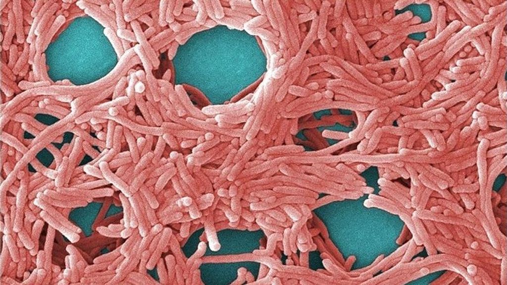 Bacteria Legionella