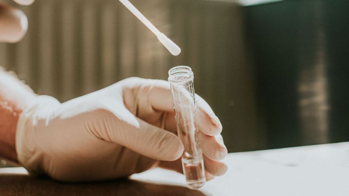 Primera mujer contagiada por la viruela del mono en España Primera mujer contagiada por la viruela del mono en España