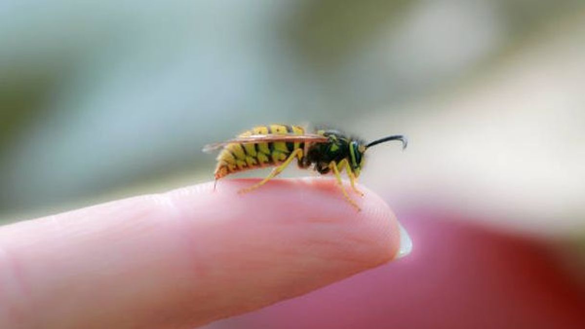 Picadura abeja. Picadura abeja.