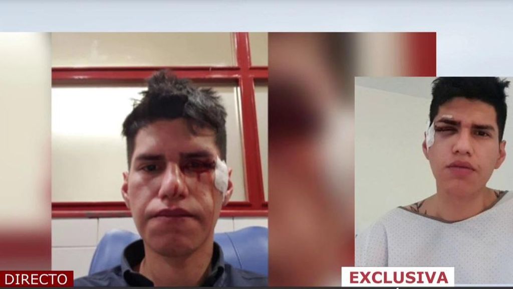 Habla en exclusiva el camarero agredido por los ultras del Frente Atlético: “Los médicos están intentando que no pierda la vista”