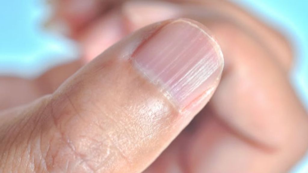 Las estrías podrán aparecer en las uñas si no se cuidan correctamente.