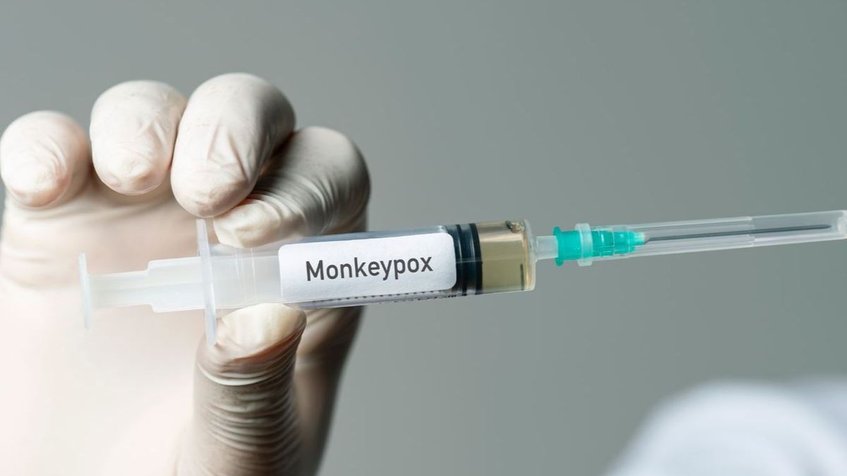 Sanidad eleva a 120 los casos de viruela del mono en España