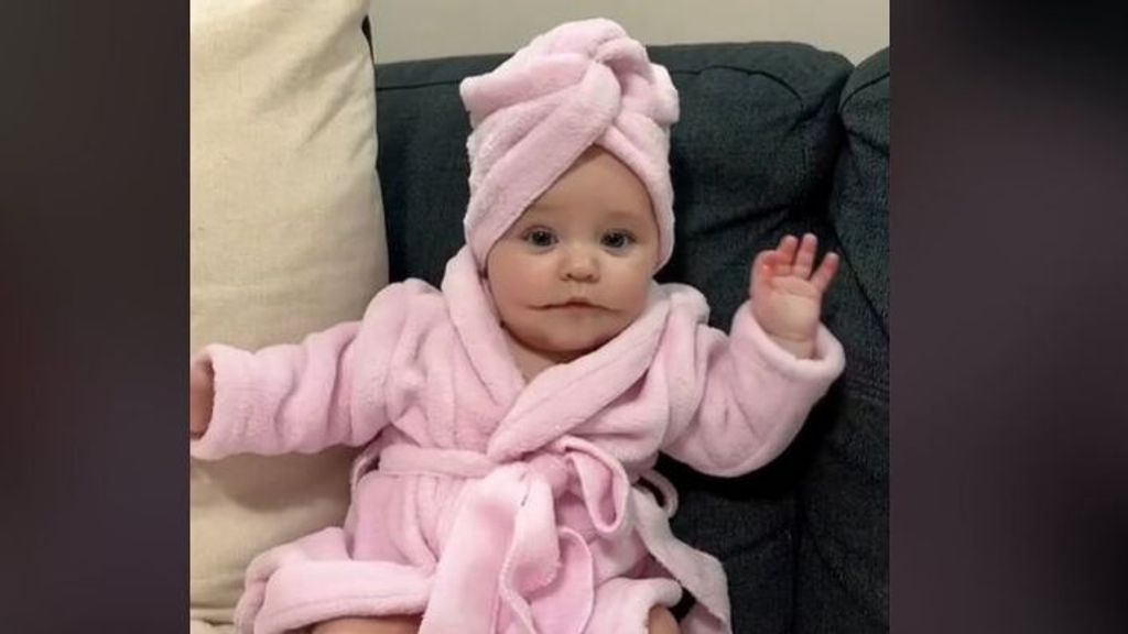 La historia de Ayla Summer, la bebé con una "sonrisa permanente"