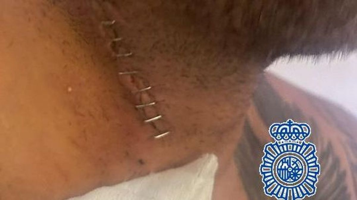 Detenido un influencer sueco por intentar matar a un hombre en Málaga Detenido un influencer sueco por intentar matar a un hombre en Málaga