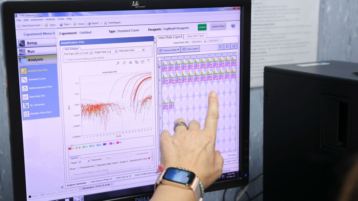 La OMS confirma 780 casos de viruela del mono en 27 países no endémicos