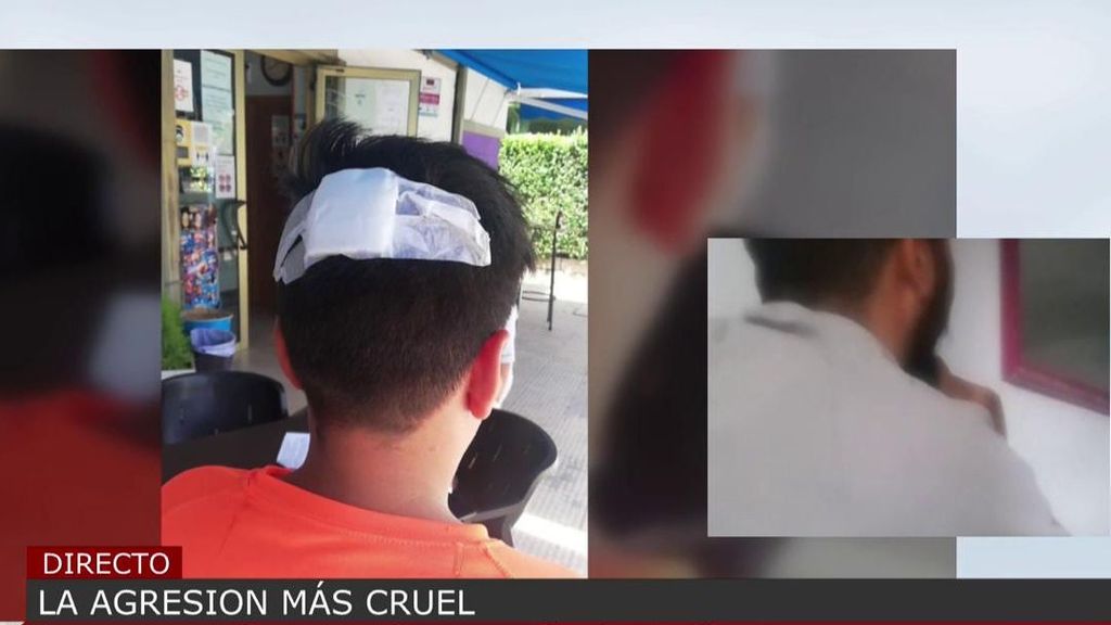 Habla el padre del niño agredido por dos menores: “Le golpearon con una barra en la cabeza, fue un intento de asesinato”