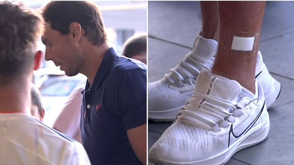 Rafa Nadal, cauto tras la primera sesión del tratamiento: "De momento, no tengo sensaciones"
