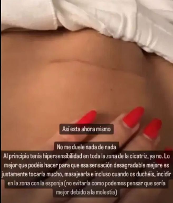 Cicatriz Carla Barber