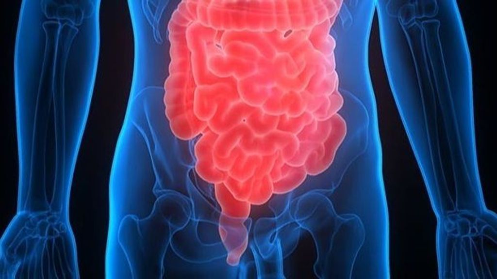Luces y sombras del medicamento contra el cáncer rectal
