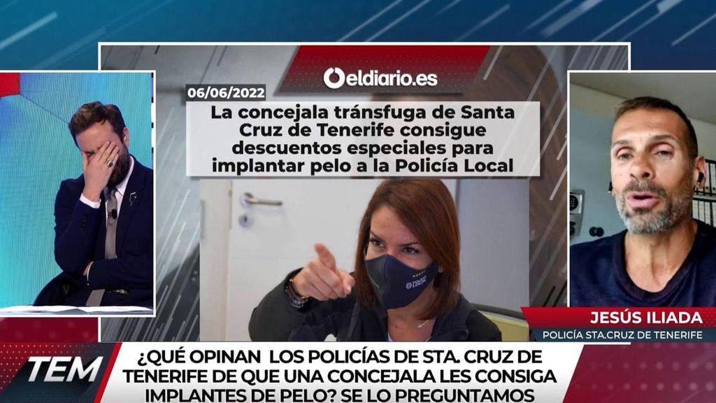 Descuentos en implantes de pelo para los policías locales de Santa Cruz de Tenerife