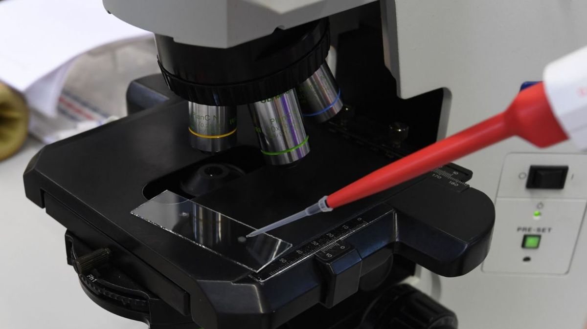Detectado por primera vez el virus de la viruela del mono en el semen de un paciente Detectado por primera vez el virus de la viruela del mono en el semen de un paciente