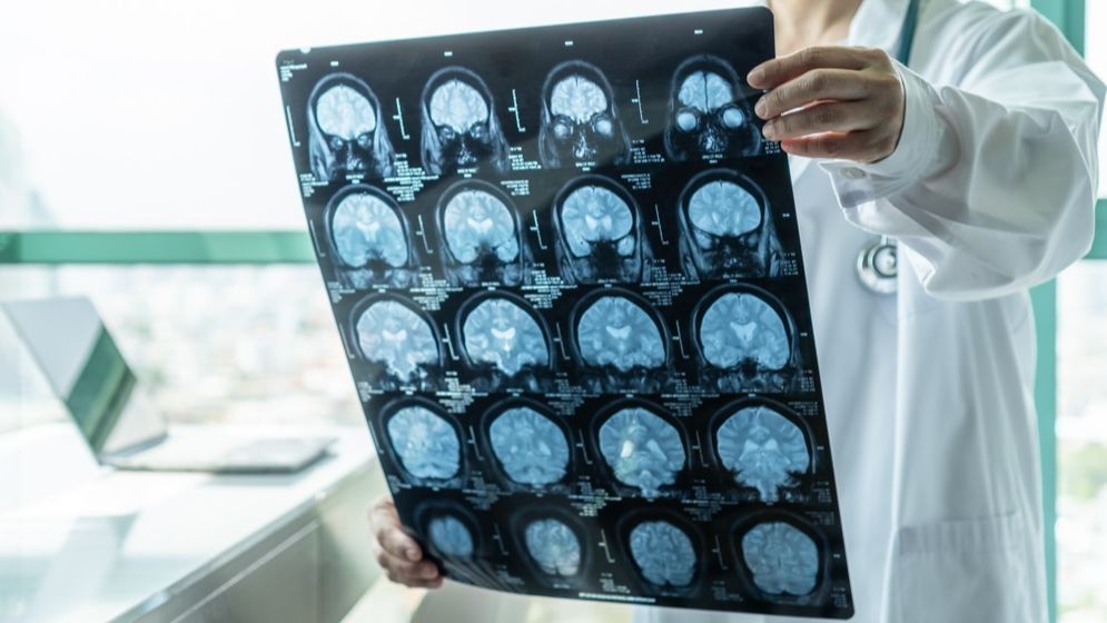 El virus de Borna puede causar encefalitis en humanos