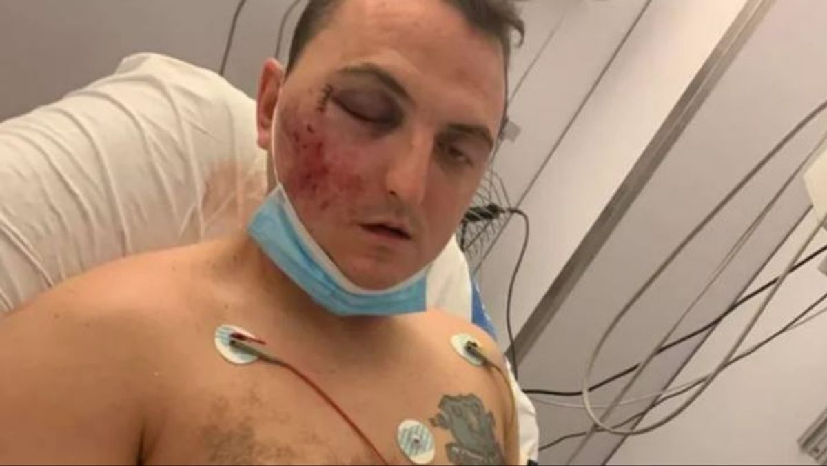 Denuncian la paliza a un joven británico presuntamente agredido y lanzado por un precipicio en Salou