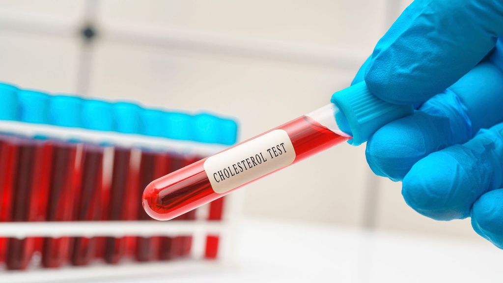 Imagen conceptual de un test de sangre para detectar niveles de colesterol