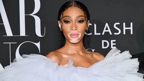 Winnie Harlow, la modelo que triunfa mostrando su piel despigmentada por el vitíligo