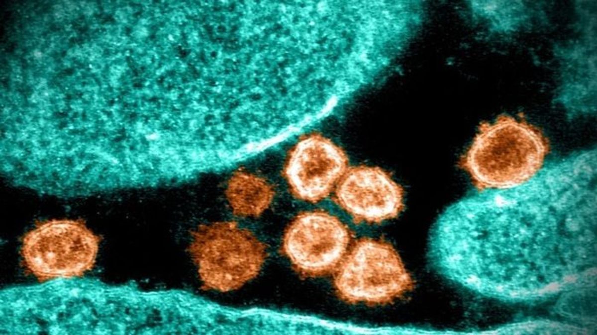 EuropaPress 4492362 imagen microscopio electronico transmision particulas virus sars cov 2