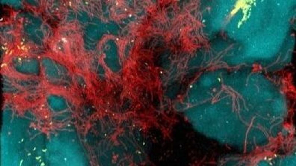 EuropaPress 2319477 cepas vibrio cholerae rojo producen celulas alargadas enredan ayudan