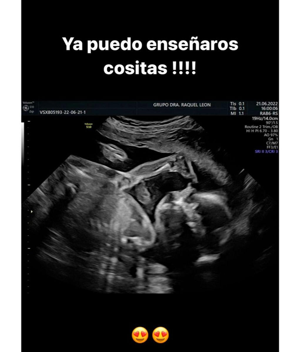 La imagen que ha publicado Isaac Torres tras conocer el sexo de su futuro bebé