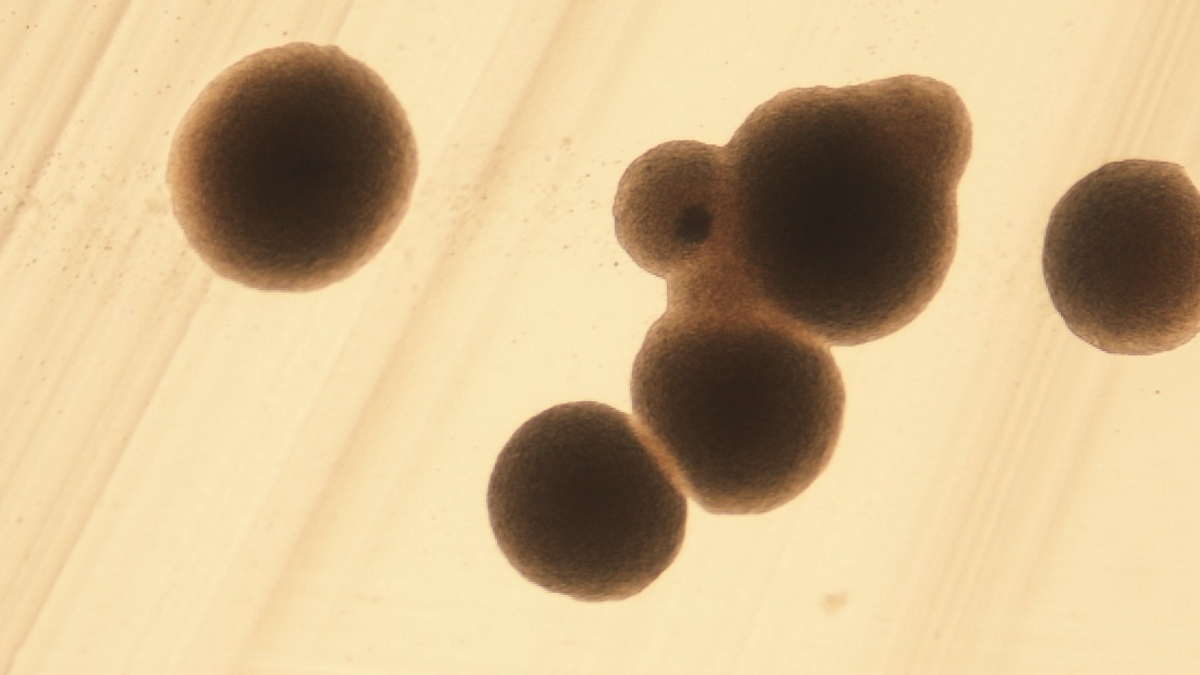 Brote de gastroenteritis en una residencia de Madrid Brote de gastroenteritis en una residencia de Madrid