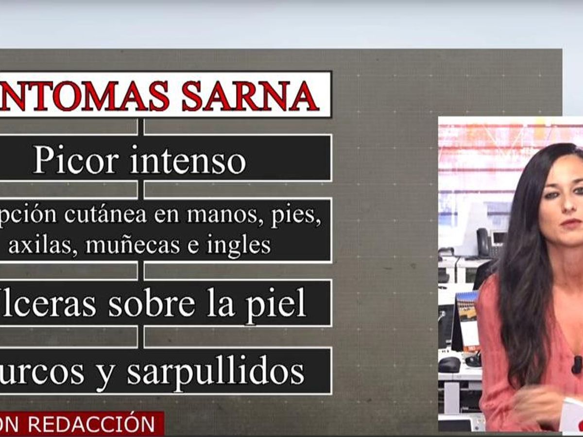 Aumentan los casos de sarna en España: qué es, cuáles son sus síntomas,  cómo se contagia