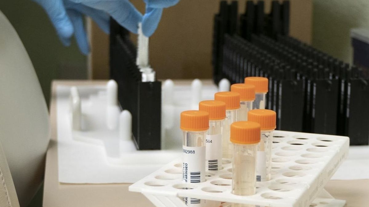 Análisis de muestras de viruela de mono en un análisis Análisis de muestras de viruela de mono en un análisis