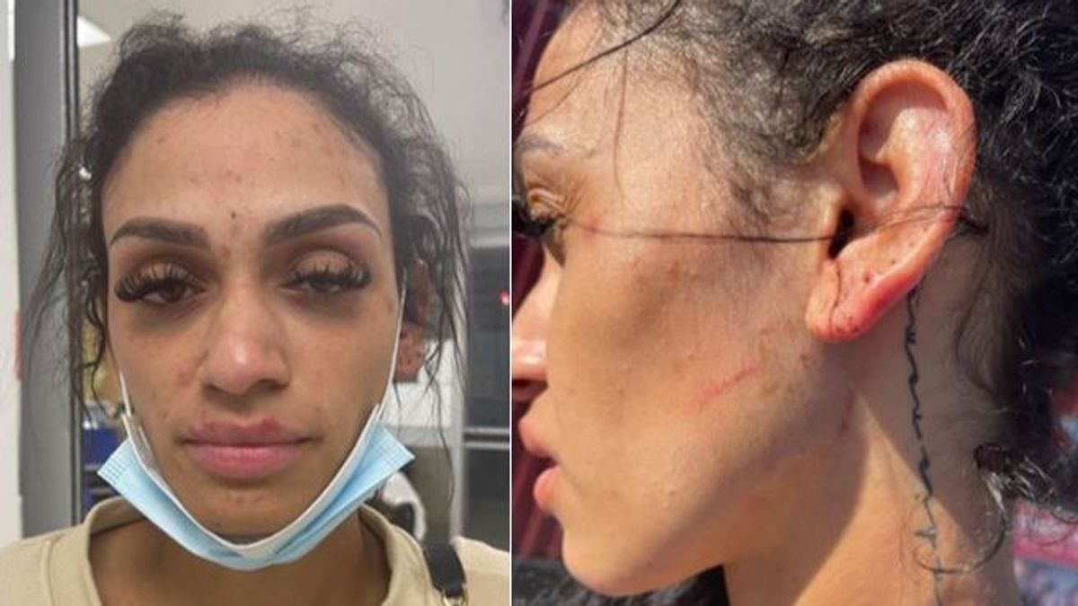 Mychelle Johnson muestra las heridas en su rostro en su cuenta de Instagram