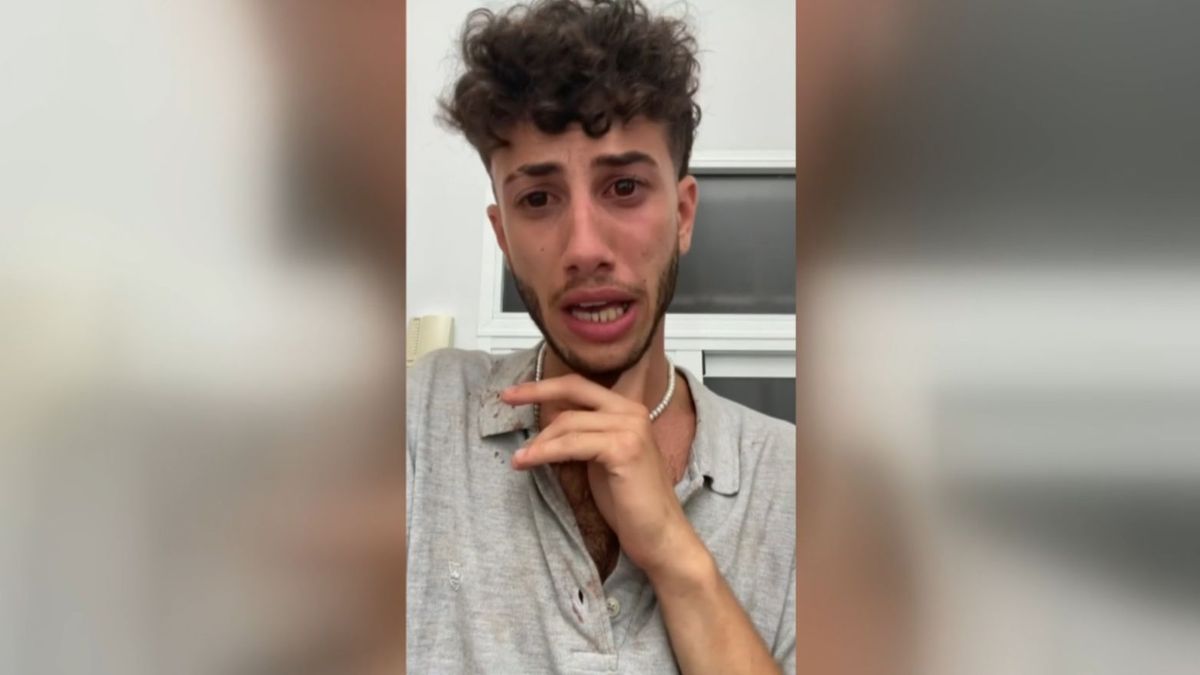 José Aguilera denuncia una agresión homófoba en Conil