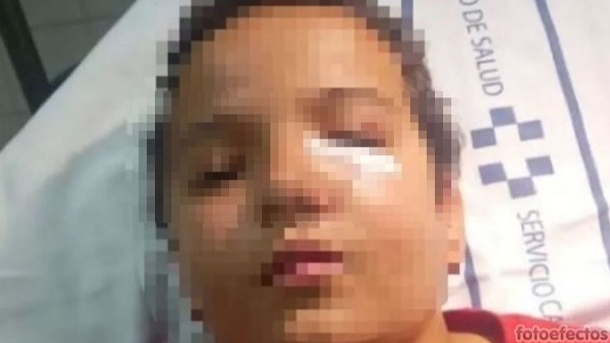 Un niño de 11 años es hospitalizado en Tenerife tras defender a su abuelo