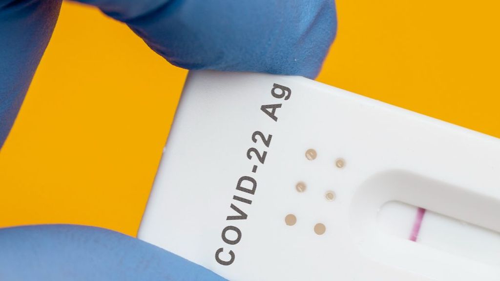 ¿Hay que actualizar el nombre de la covid-19?