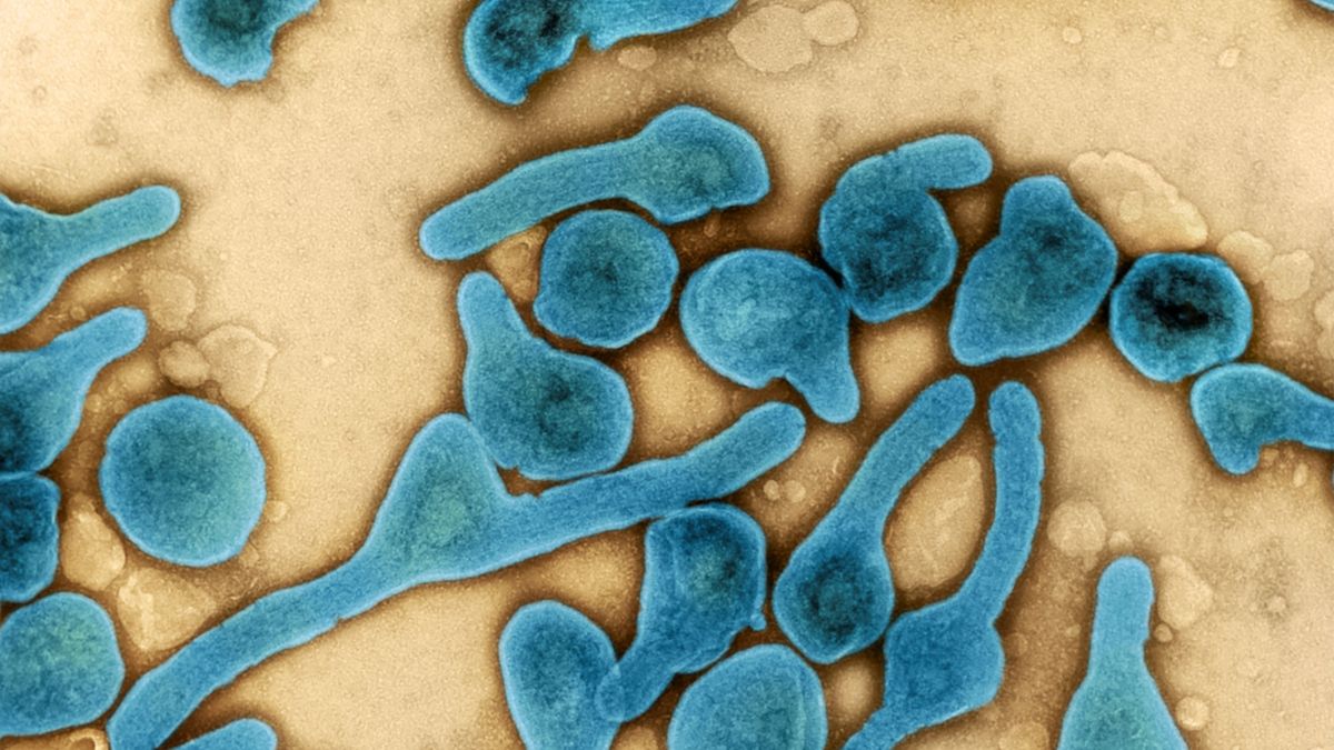 Virus de Marburgo: síntomas, período de incubación y formas de contagiarse