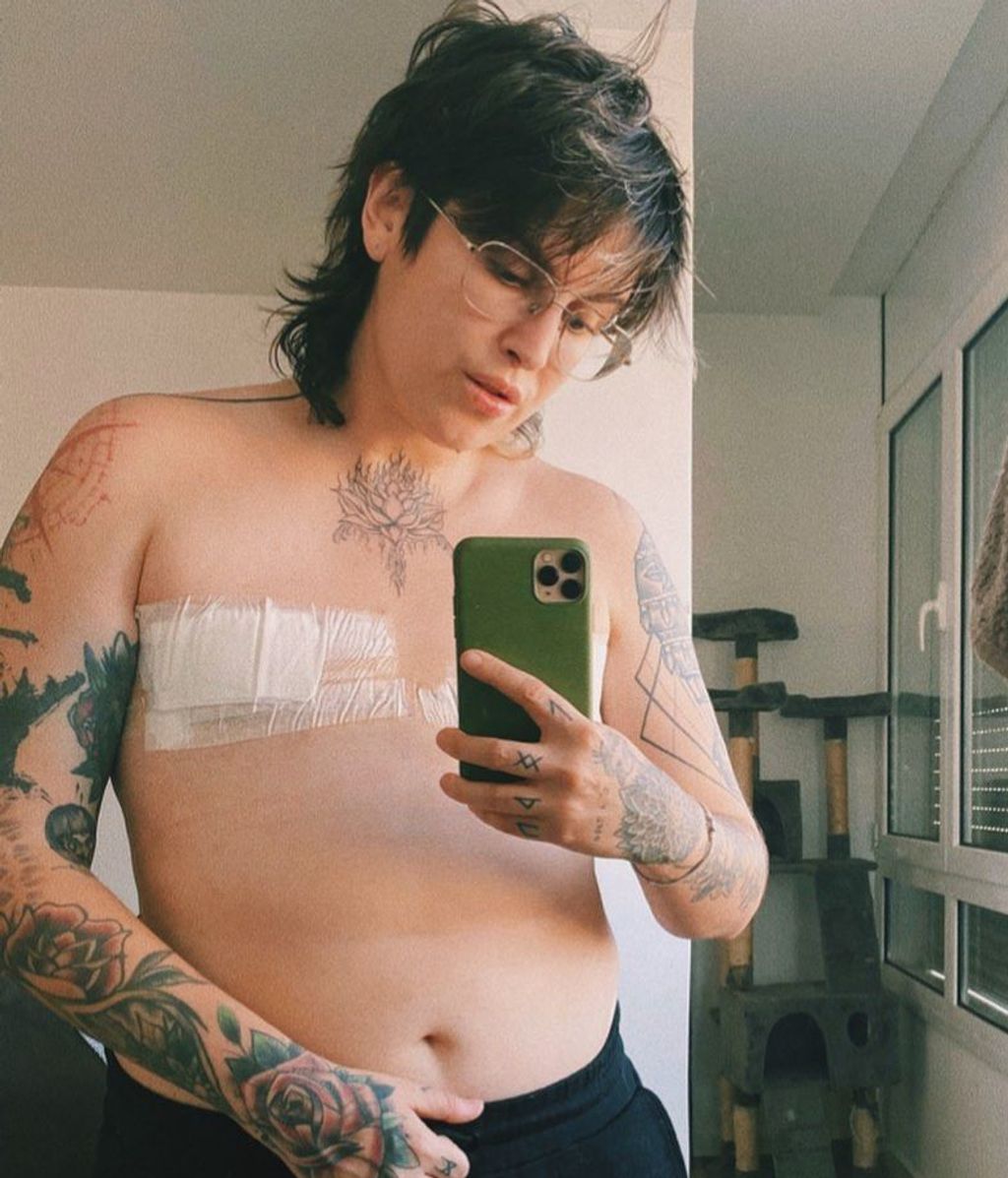 Melo Moreno tras su mastectomía