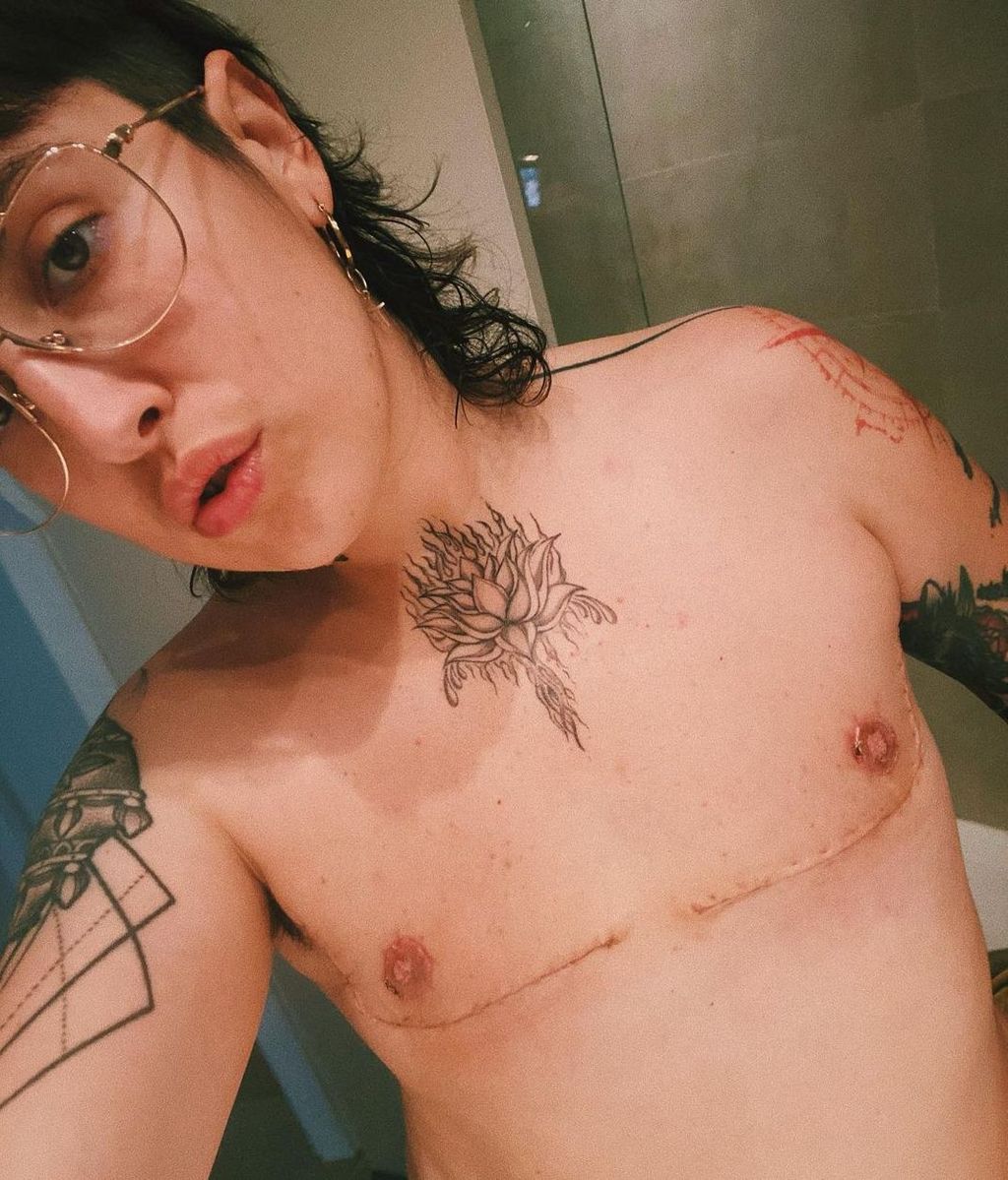 Melo Moreno un mes después de su mastectomía