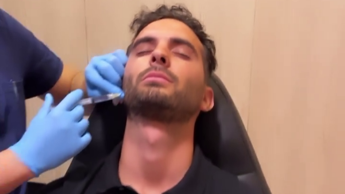 Suso Álvarez se realiza un retoque estético para rejuvenecer su rostro