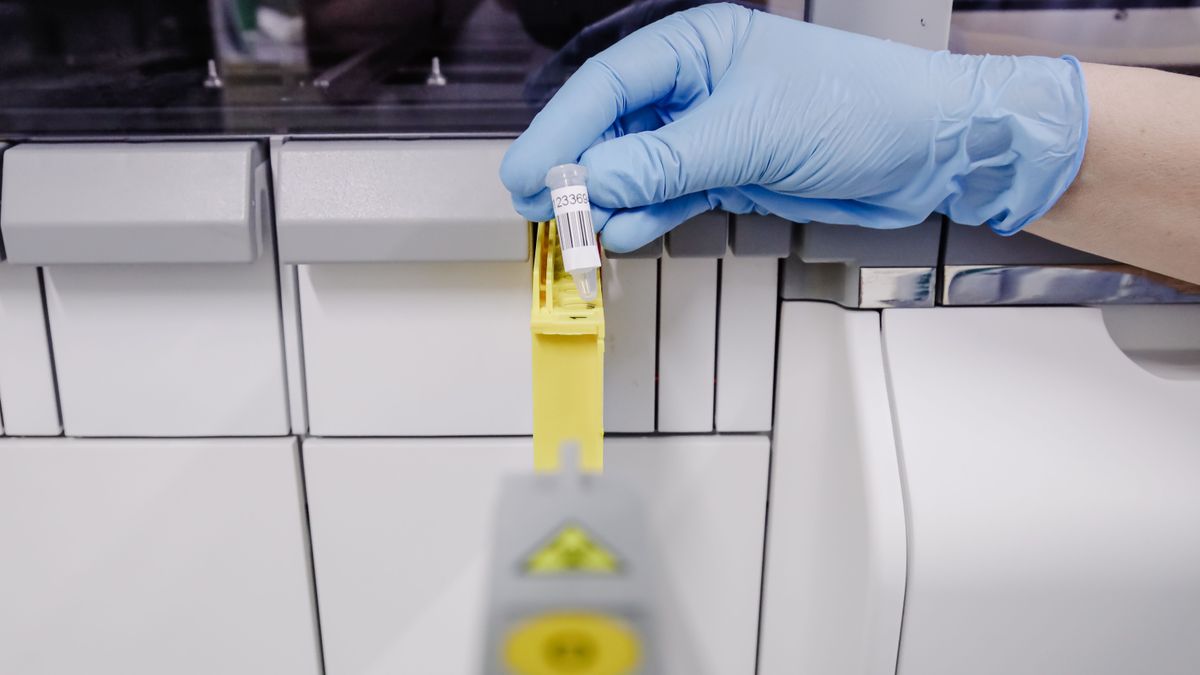 Canarias suma dos nuevos casos de viruela del mono: en toda España son ya más de 3.000 Canarias suma dos nuevos casos de viruela del mono: en toda España son ya más de 3.000