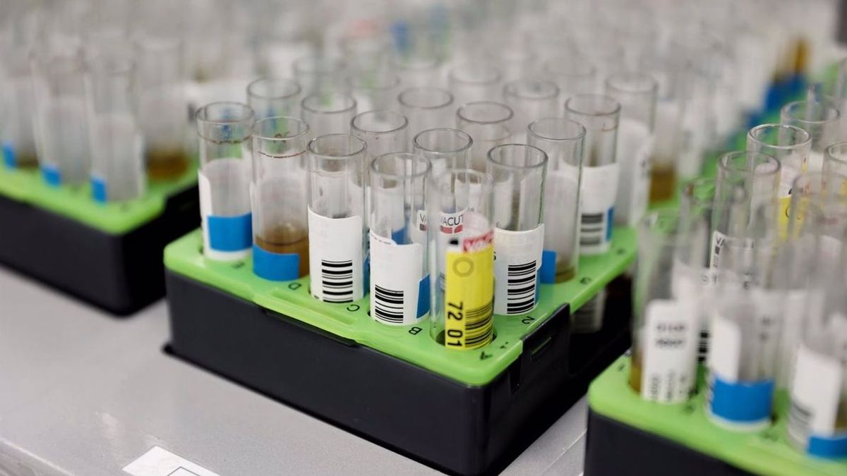 Análisis de muestras de viruela del mono Análisis de muestras de viruela del mono