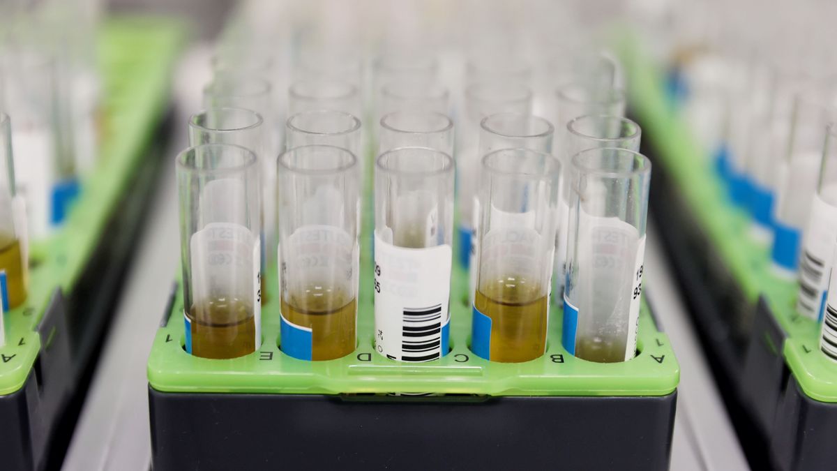 Probetas de pruebas PCR en un laboratorio Probetas de pruebas PCR en un laboratorio