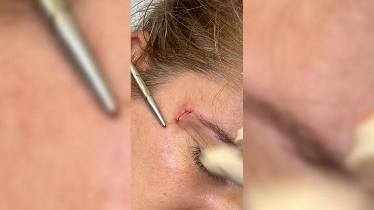 Atacan en Melilla a una técnico sanitaria mientras atendía a un herido Atacan en Melilla a una técnico sanitaria mientras atendía a un herido