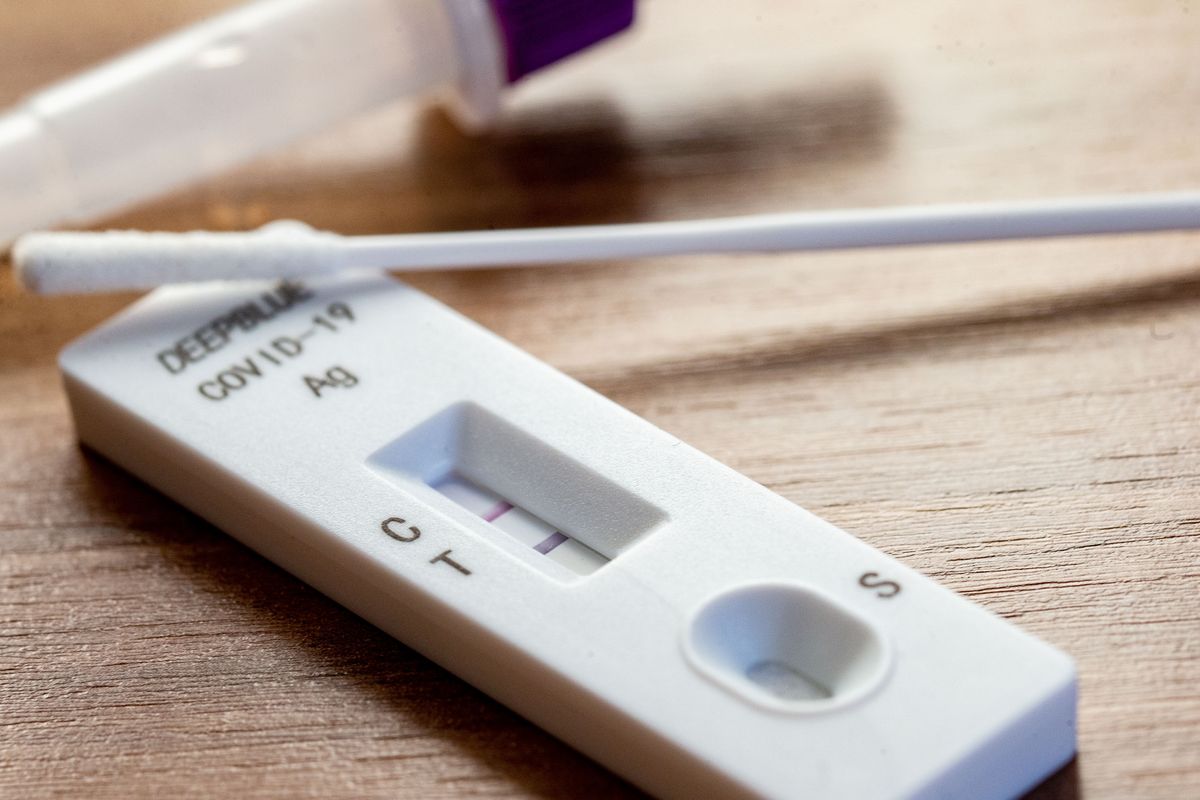 Test de antígenos de coronavirus Test de antígenos de coronavirus