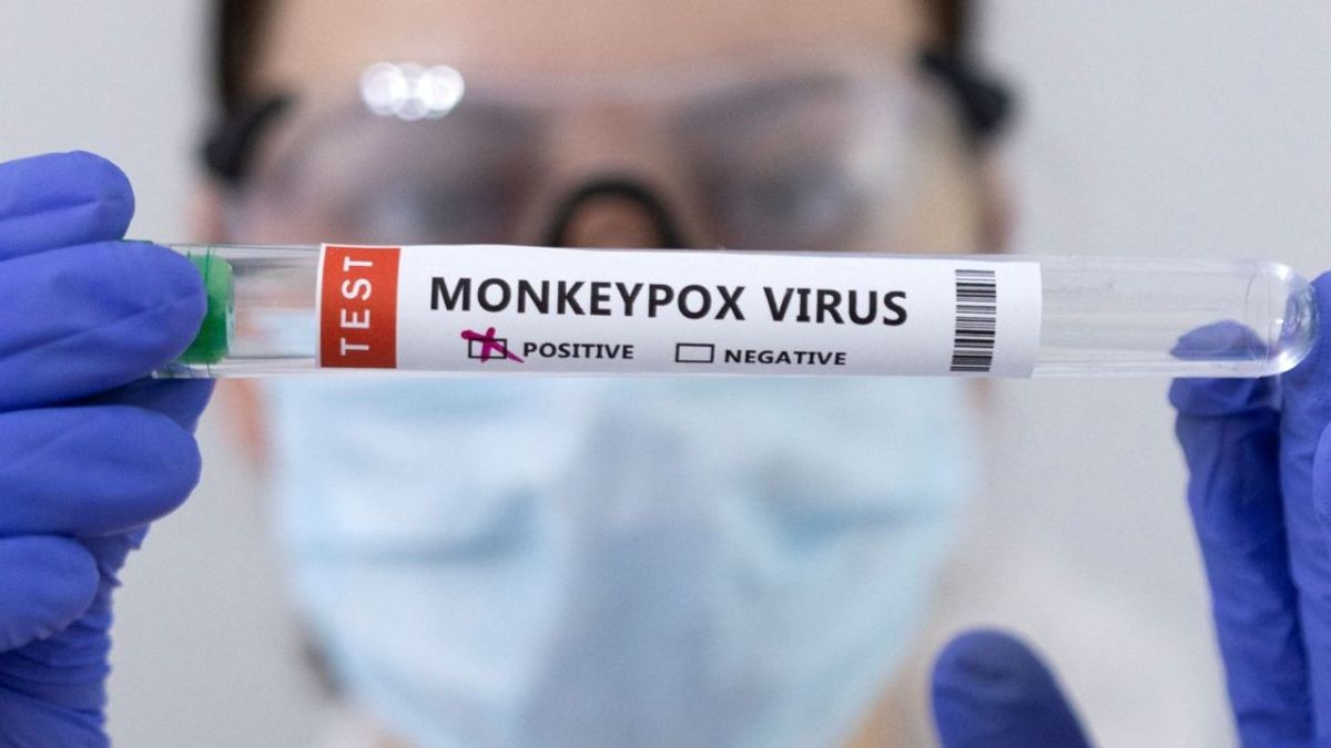 Los casos de viruela del mono obliga a California a declarar el estado de emergencia