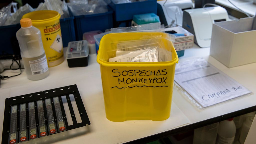 ¿Por qué en España hay tantos casos de viruela de mono?